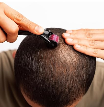 Hair Roller 0.5mm – Boost Hair & Beard Growth | 540 Titanium Needles | Reduce Acne Scars, Repair Damaged Hair & Strengthen Roots | Safe, Easy & Effective for Men & Women|(P-2161)